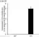 Fig. 28 - QUANTITATIVE DETERMINATION METHOD FOR Hex4, LYSO-GM1, Fuc-GlcNAc-Asn, AND LYSO-SULFATIDE INCLUDED IN CEREBROSPINAL FLUID