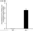 Fig. 29 - QUANTITATIVE DETERMINATION METHOD FOR Hex4, LYSO-GM1, Fuc-GlcNAc-Asn, AND LYSO-SULFATIDE INCLUDED IN CEREBROSPINAL FLUID
