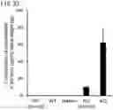 Fig. 34 - QUANTITATIVE DETERMINATION METHOD FOR Hex4, LYSO-GM1, Fuc-GlcNAc-Asn, AND LYSO-SULFATIDE INCLUDED IN CEREBROSPINAL FLUID