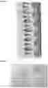 Fig. 11 - LATERAL FLOW DEVICE