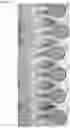 Fig. 15 - LATERAL FLOW DEVICE