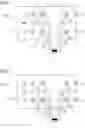 Fig. 03 - MR system with improved protection against cardiac stimulation