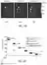 Fig. 11 - System and method for free-breathing quantitative multiparametric mri