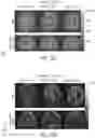 Fig. 12 - System and method for free-breathing quantitative multiparametric mri
