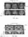 Fig. 13 - System and method for free-breathing quantitative multiparametric mri