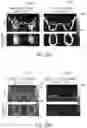 Fig. 15 - System and method for free-breathing quantitative multiparametric mri