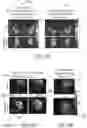 Fig. 16 - System and method for free-breathing quantitative multiparametric mri