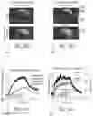 Fig. 17 - System and method for free-breathing quantitative multiparametric mri