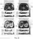 Fig. 20 - System and method for free-breathing quantitative multiparametric mri