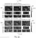 Fig. 23 - System and method for free-breathing quantitative multiparametric mri
