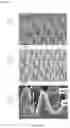 Fig. 04 - Optical transmission element, having a super-hydrophobic nanostructured surface having an anti-reflective property and covered with a compliant high-density thin film deposit