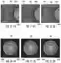 Fig. 13 - Methods for detection of contaminants on optical fiber connectors