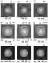 Fig. 15 - Methods for detection of contaminants on optical fiber connectors