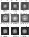 Fig. 16 - Methods for detection of contaminants on optical fiber connectors