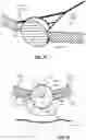 Fig. 09 - Microsphere holder