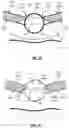 Fig. 12 - Microsphere holder