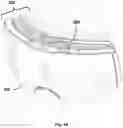 Fig. 06 - ELECTRICALLY CONDUCTIVE LAMINATED LENS FOR EYEWEAR AND FRAME ASSEMBLY THEREFOR