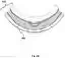 Fig. 07 - ELECTRICALLY CONDUCTIVE LAMINATED LENS FOR EYEWEAR AND FRAME ASSEMBLY THEREFOR