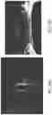 Fig. 11 - SYSTEMS AND METHODS FOR AUTONOMOUS NAVIGATION ON SIDEWALKS IN VARIOUS CONDITIONS