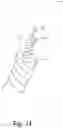 Fig. 12 - Detecting twist input with an interactive cord