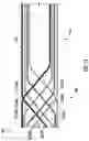 Fig. 12 - Touch-sensitive braided cord