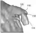 Fig. 01 - Modeling a patient-individualised denture part