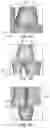 Fig. 06 - Modeling a patient-individualised denture part