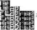 Fig. 09 - Method, device, and computer program product for self-supervised learning of pixel-wise anatomical embeddings in medical images
