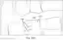 Fig. 46 - Artificial Intelligence Platform for Dental Claims Adjudication Prediction Based on Radiographic Clinical Findings