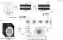 Fig. 01 - K-space based method for reducing noise and dose of radiation or contrast for perfusion imaging
