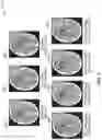 Fig. 09 - K-space based method for reducing noise and dose of radiation or contrast for perfusion imaging