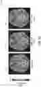 Fig. 12 - K-space based method for reducing noise and dose of radiation or contrast for perfusion imaging