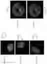 Fig. 02 - Image correction for ophthalmic images