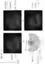 Fig. 07 - Image correction for ophthalmic images