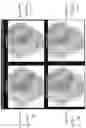 Fig. 14 - Image correction for ophthalmic images
