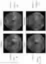 Fig. 15 - Image correction for ophthalmic images