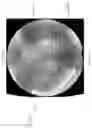 Fig. 16 - Image correction for ophthalmic images