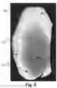 Fig. 03 - System and method for determining 3D surface features and irregularities on an object