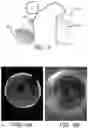 Fig. 04 - DIAGNOSTIC TOOL FOR EYE DISEASE DETECTION