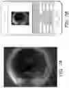 Fig. 07 - DIAGNOSTIC TOOL FOR EYE DISEASE DETECTION