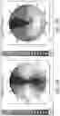 Fig. 14 - DIAGNOSTIC TOOL FOR EYE DISEASE DETECTION
