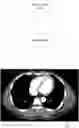 Fig. 01 - Systems and methods for facilitating opportunistic screening for cardiomegaly
