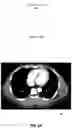 Fig. 06 - Systems and methods for facilitating opportunistic screening for cardiomegaly
