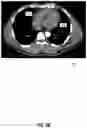 Fig. 07 - Systems and methods for facilitating opportunistic screening for cardiomegaly