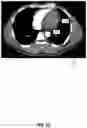 Fig. 08 - Systems and methods for facilitating opportunistic screening for cardiomegaly