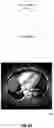 Fig. 09 - Systems and methods for facilitating opportunistic screening for cardiomegaly