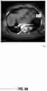 Fig. 10 - Systems and methods for facilitating opportunistic screening for cardiomegaly