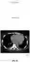 Fig. 12 - Systems and methods for facilitating opportunistic screening for cardiomegaly