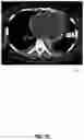 Fig. 13 - Systems and methods for facilitating opportunistic screening for cardiomegaly