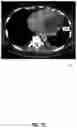 Fig. 14 - Systems and methods for facilitating opportunistic screening for cardiomegaly